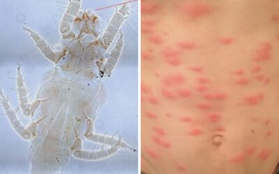 Les Pyemotes : les acariens du bois